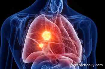 A Rare and Deadly Cancer May Have an Unexpected New Vulnerability