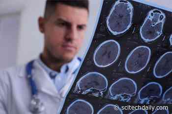Sleep Disorders Don’t Just Exhaust You. New Research Shows They Change Your Brain