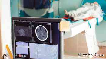 Albertans can pay for MRIs and other tests without a doctor's referral, as of Friday