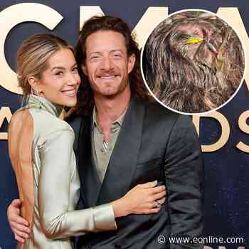 Florida Georgia Line's Tyler Hubbard Gets Fish Hook Removed From Head