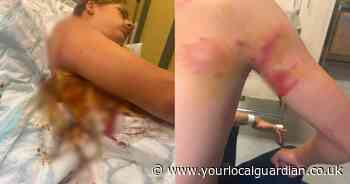 ‘My terrified son was mauled by a police dog in Sutton – he could have died’