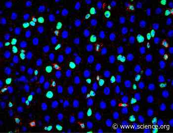 A reduction in A-to-I RNA editing by ADAR disrupts Pumilio-mediated inhibition of MAPK signaling to drive intestinal stem cell aging | Science Signaling
