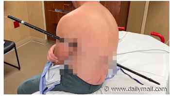 Hiker IMPALES himself in freak accident on side of a mountain - then walked 10 more miles to avoid getting ambulance bill