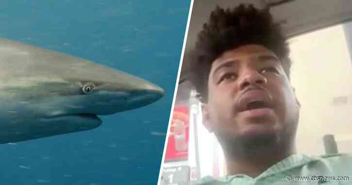 Georgia man recounts Florida shark attack after saving pregnant fiancee: "A whole lot of blood"