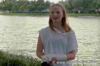 Rare barracuda attack on Caribbean vacation leaves Texas teen in need of surgery