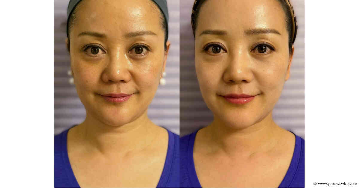 New 12-Week Consumer Study Highlights Visible Skin Benefits with USANA Glow