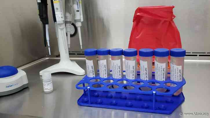 Evidence of measles virus found in Anchorage wastewater