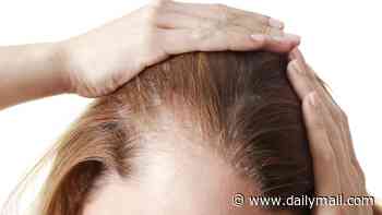 Some weight loss jabs are more likely to make you bald than others, study finds - and it's worse for women