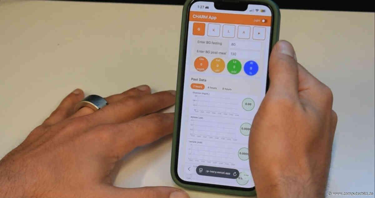 Dieser Smart Ring könnte den Alltag vieler Diabetiker verändern