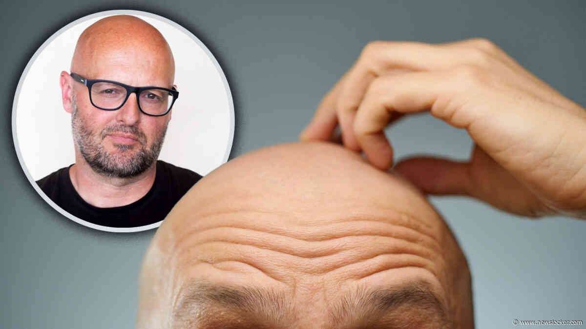 Koen (55) werd al op zijn 17e kaal en dat had enorme impact: ’Er waren periodes dat ik mijn bed niet meer uitkwam’