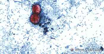 Doctor warns against 'cyclospora skinny' trend