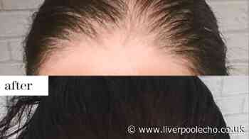 Woman with thinning hair 'lost confidence' but £100 off gadget 'amazed hairdresser'