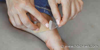 Instead of popping a blister, follow this treatment plan