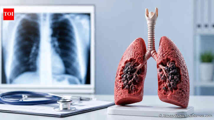 More non-smokers, youth detected with lung cancer