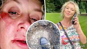 Woman, 48, left ‘on the floor with blood everywhere’ after tripping on pothole