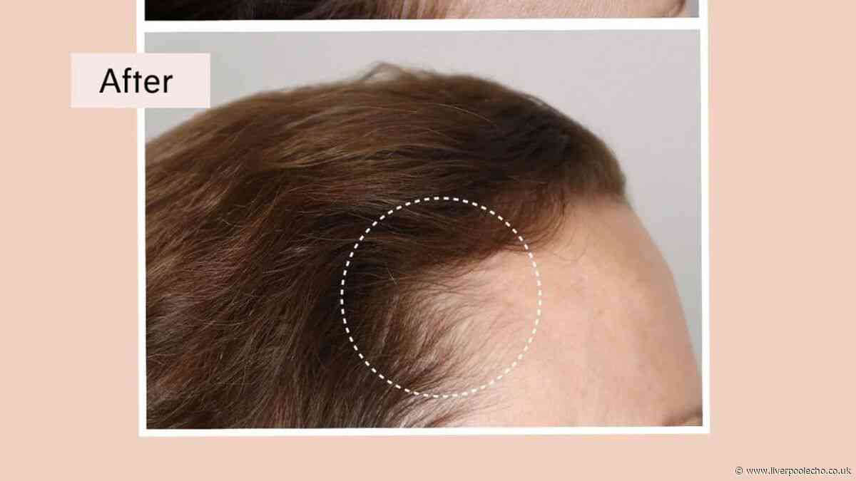 Four 'fast working' products to tackle hair loss and thinning