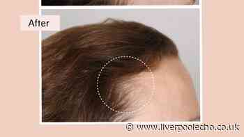 Four 'fast working' products to tackle hair loss and thinning