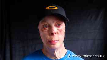 'I died 3 times in Army bomb blast but I'd still let my son join up'