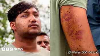 India's 'cockroach' protesters have wounds consistent with pellet-gun fire, say experts