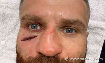Jan Blachowicz shows off gnarly cut after UFC Belgrade loss