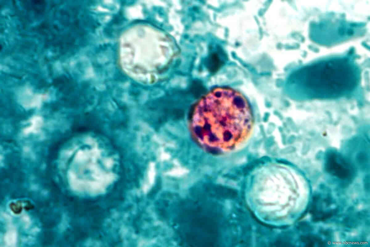 Michigan reports first two deaths in the cyclosporiasis outbreak