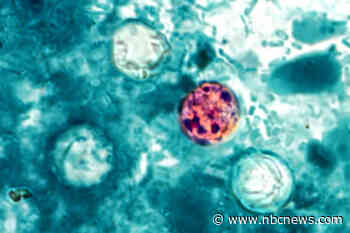 Michigan reports first two deaths in the cyclosporiasis outbreak