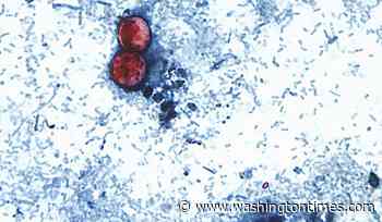 Michigan reports the first 2 U.S. deaths related to a diarrhea-causing parasite