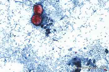 Michigan reports the first 2 US deaths related to a diarrhea-causing parasite