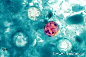 Michigan Cyclosporiasis Outbreak: What Are the Symptoms and Is Taylor Farms Lettuce Safe?