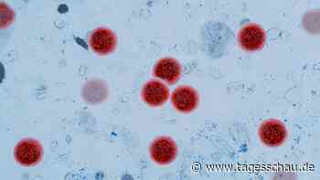 Cyclospora-Parasit: Mehr als 10.000 Durchfall-Infektionen in den USA