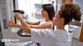 Breast cancer checks missing most women under 50 who are at risk, says study