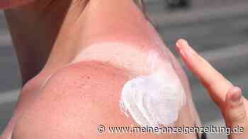 „Tanmaxxing“-Trend: Experten warnen vor Sonnenbrand