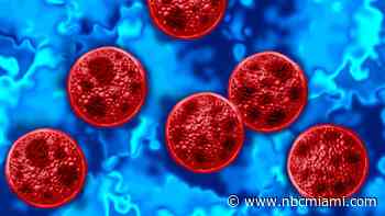 Cyclosporiasis outbreak continues to grow in Florida, with around 100 new cases
