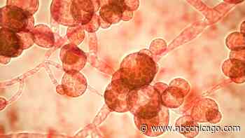 Drug-resistant fungal infections are spreading in U.S., Illinois. What to know