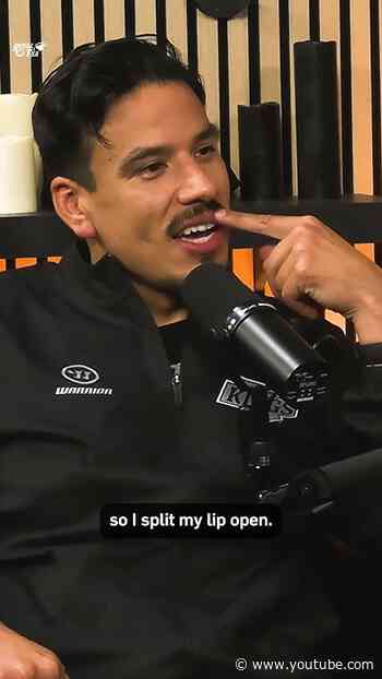 How to Lose a Tooth 101 🤣