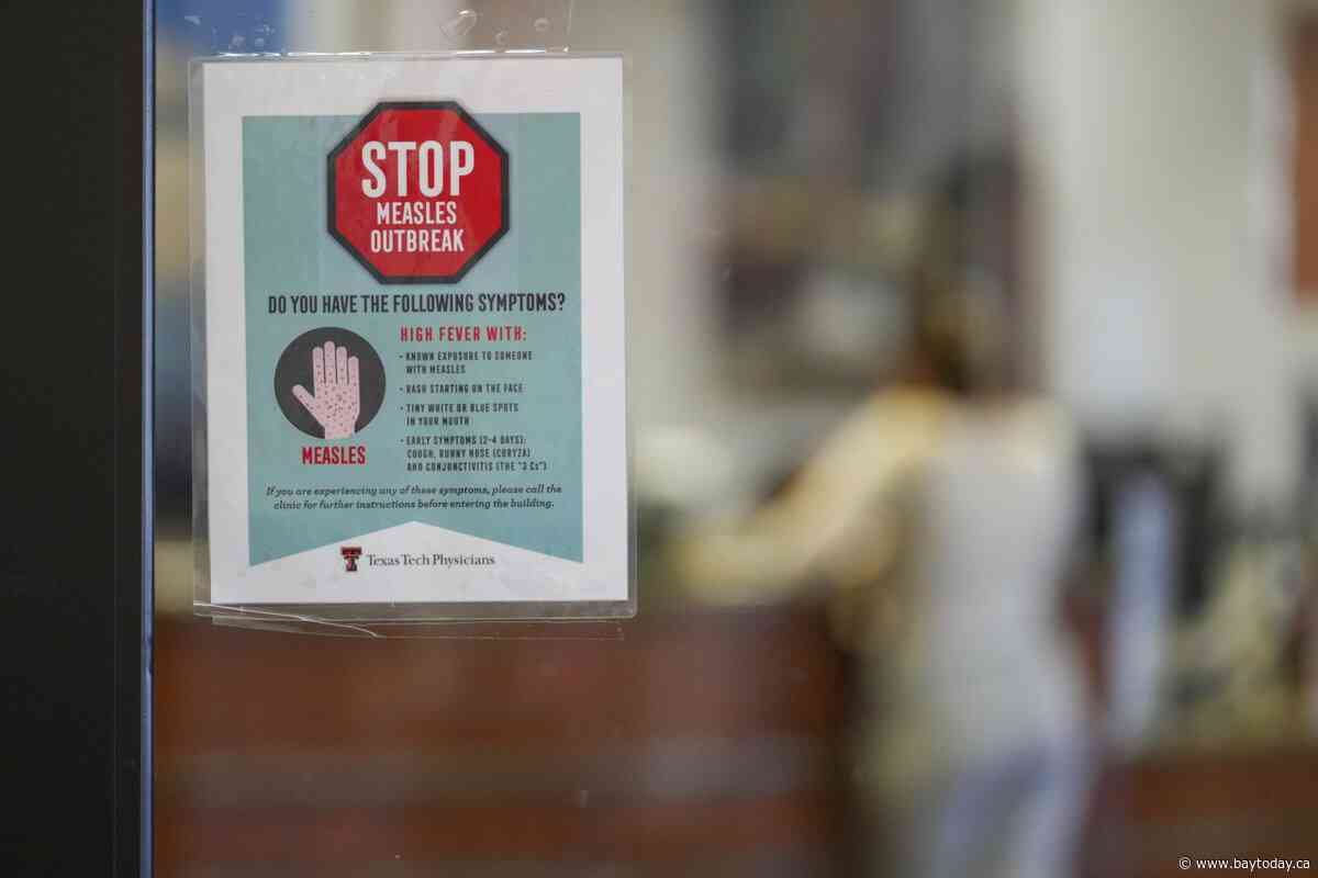 Canada has half as many measles cases as U.S.: WHO data