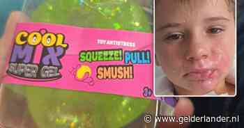 Frankrijk kondigt onderzoek aan naar ontplofte squishy waarbij 8-jarig jongetje brandwonden opliep