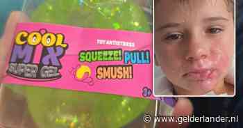 Frankrijk kondigt onderzoek aan naar ontplofte squishy waarbij 8-jarig jongetje brandwonden opliep