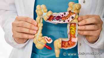 My stomach is constantly gurgling and bubbling and I've had to take Gaviscon for years... what's wrong with me? DR SCURR reveals what's going on - and the test you must ask your doctor for