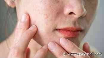 The daily routine and diet that could transform psoriasis-prone skin in just six weeks... and the 'healthy' daily drink that could be your worst enemy