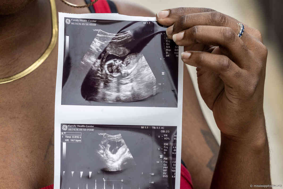 Maternity care deserts make up nearly half of Mississippi counties, March of Dimes says