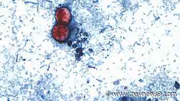 15 states now linked to iceberg lettuce cyclospora outbreak, CDC says