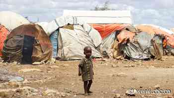 Somalia child hunger surges as aid drops, Doctors Without Borders says