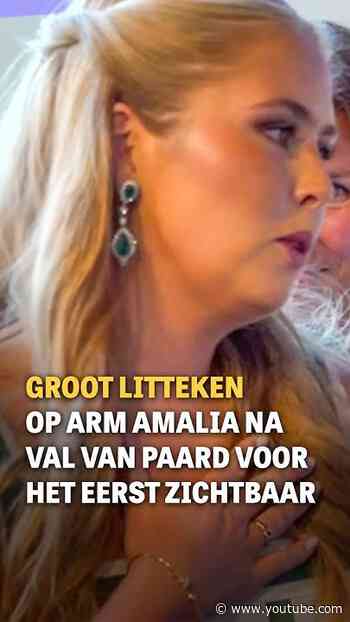 Groot litteken Amalia voor het eerst zichtbaar