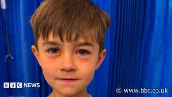 Boy, four, taken to hospital after fake squishy toy explodes in his face