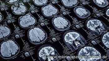 Wissenschaftler entdecken möglichen Auslöser von Alzheimer – er beginnt schon mit 50 Jahren
