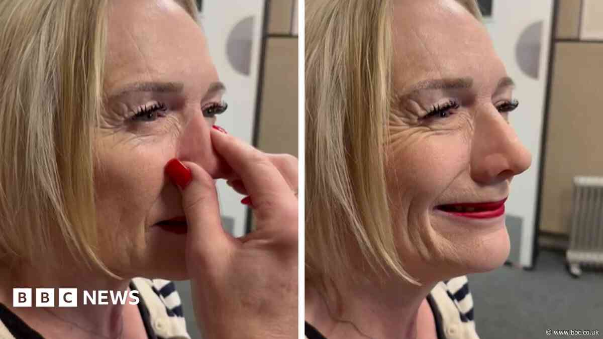 The specialist who gave a woman her confidence back with a prosthetic nose