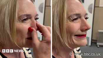 The specialist who gave a woman her confidence back with a prosthetic nose