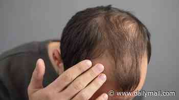 Arthritis drug can cure baldness in six months, study finds