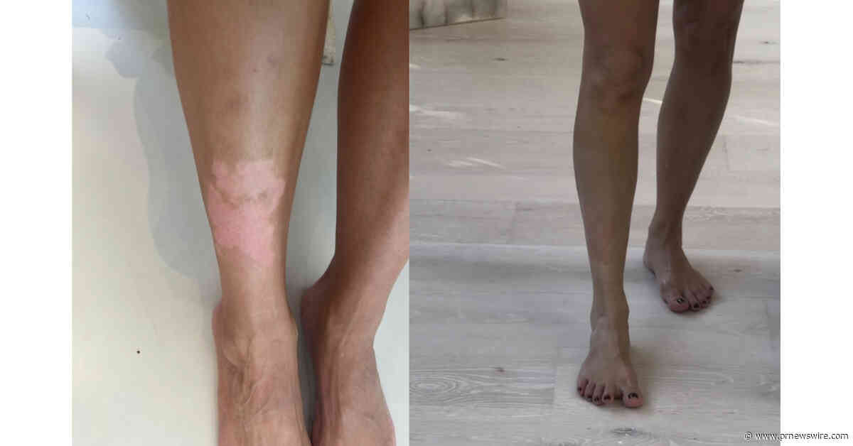 Kim Kardashian Turns to Broc Shot as Her New Skin Health Game-Changer